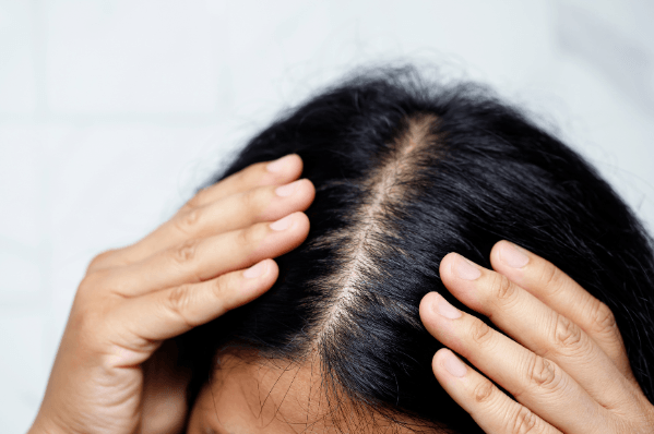 Gesunde Haare und Kopfhautpflege im Detail