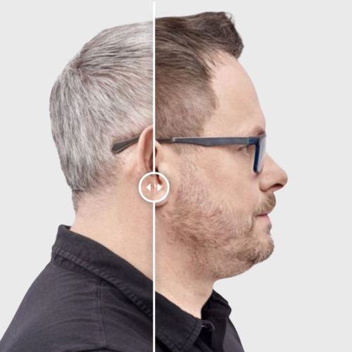 GR-7® vs. NoGrey – der wahre Unterschied bei grauen Haaren